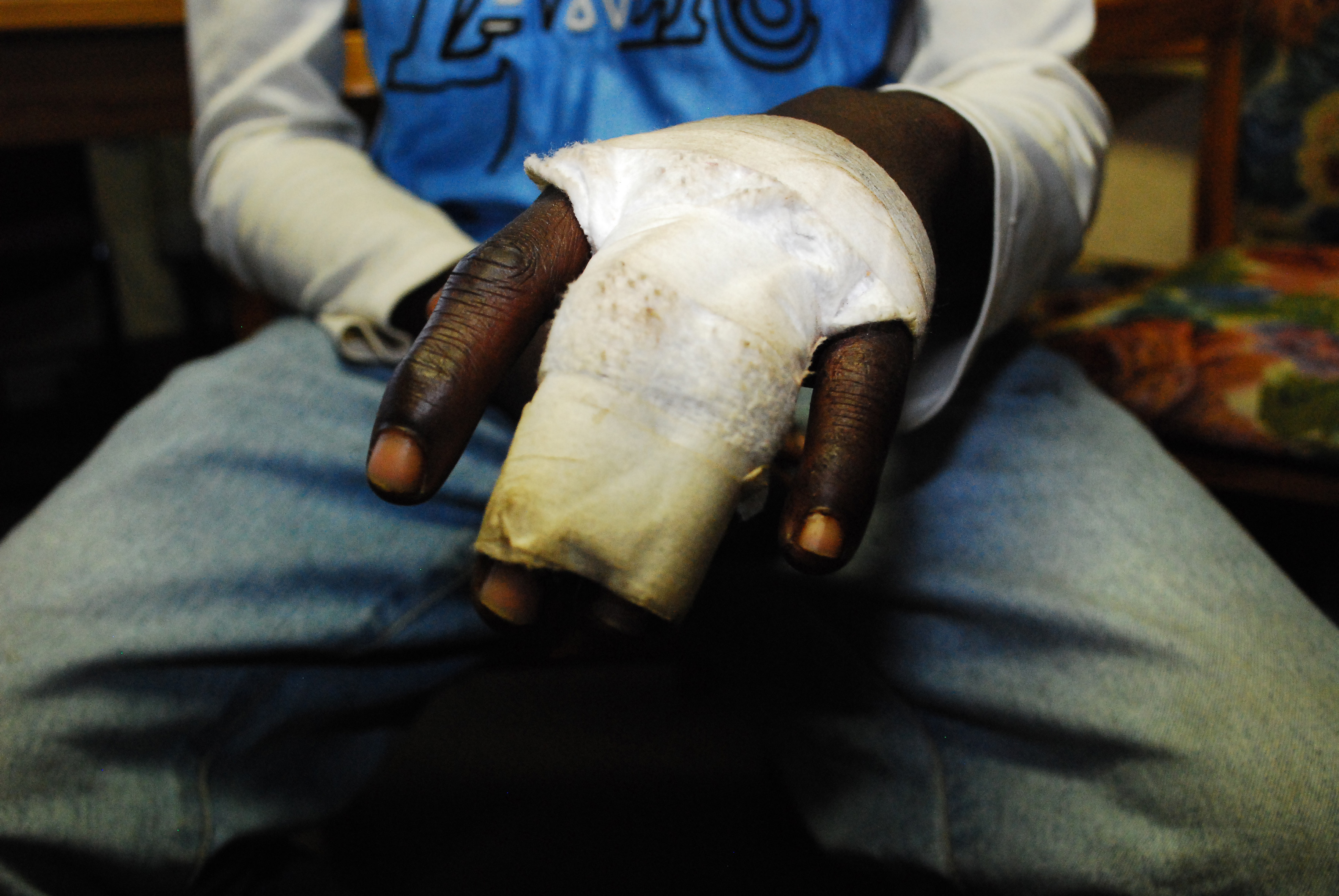 Simbabwe_80475_Opfer von Gewalt in Simbabwe_c_Amnesty International.jpg