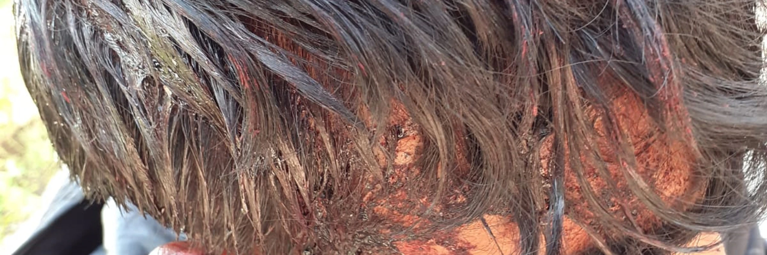 © Danish Refugee Council