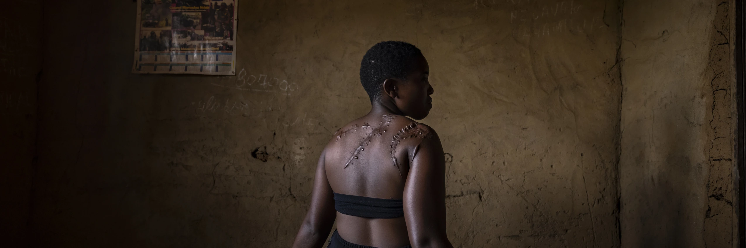 Eine Frau wurde 2019 in ihrem Haus von Mitgliedern der islamistischen Gruppe ADF angegriffen © Brent Stirton/Getty Images